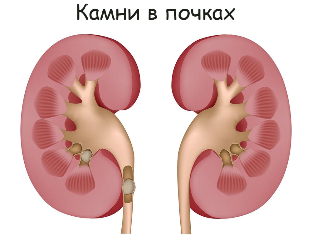 Kra38at